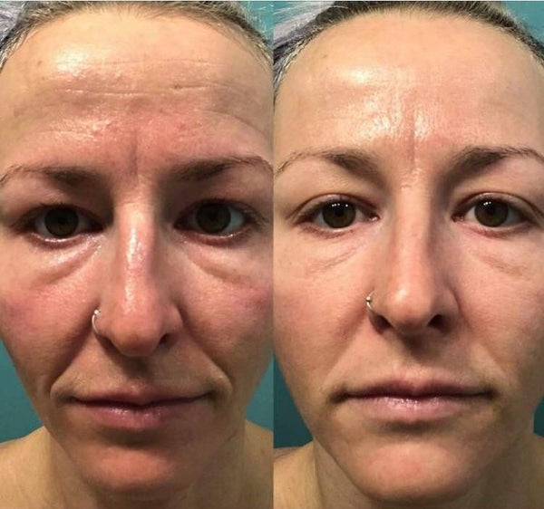 Pas de botox. Pas de chirurgie. Pas de routines avec +15 produits a 200€. Juste des nutriments purs.