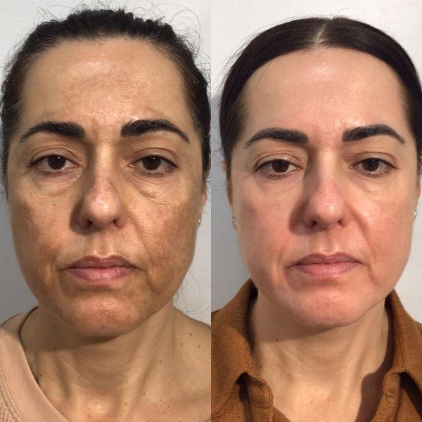 Pas de botox. Pas de chirurgie. Pas de routines avec +15 produits. Juste des nutriments purs.