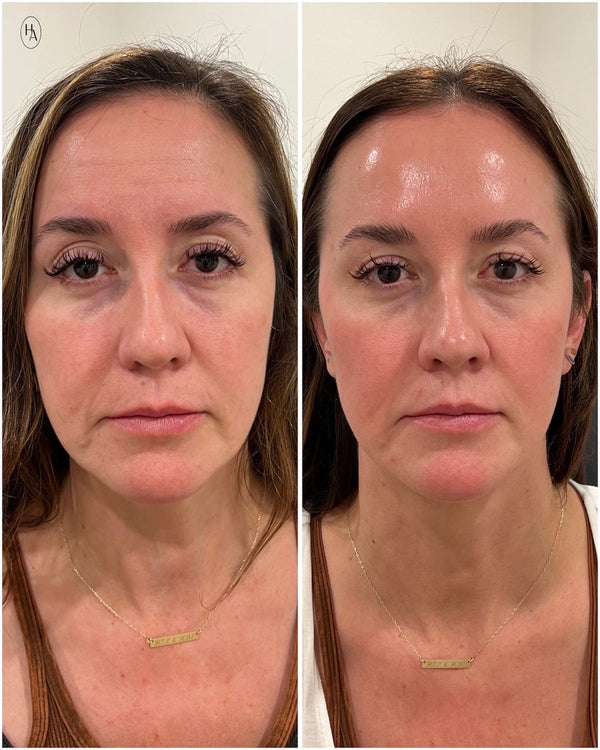 Pas de botox. Pas de chirurgie. Pas de routines avec +15 produits a 200€. Juste des nutriments purs.