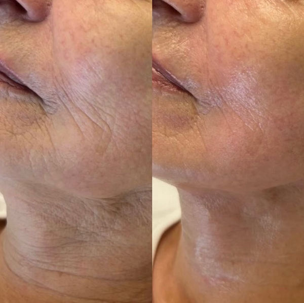 Pas de botox. Pas de chirurgie. Pas de routines avec +15 produits a 200€. Juste des nutriments purs.