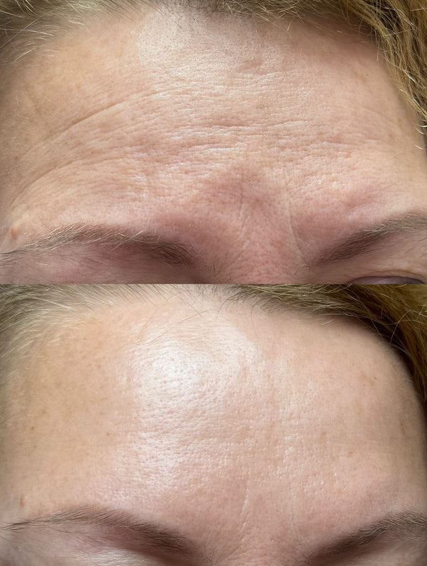 Pas de botox. Pas de chirurgie. Pas de routines avec +15 produits a 200€. Juste des nutriments purs.
